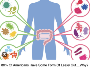 80% OF AMERICANS HAVE SOME FORM OF LEAKY GUT....WHY?